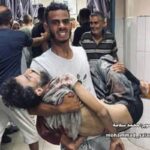 foto_msf-150x150 Gaza tem mais 5 mortes por fome em 24 horas, aponta Palestina